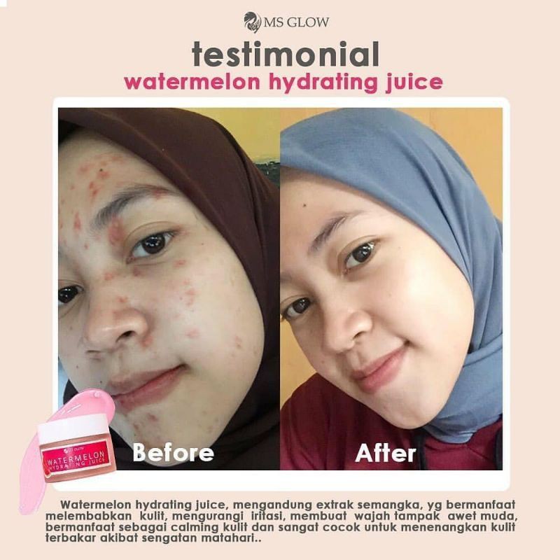 JUICE MOISTURIZER MS GLOW ORIGINAL