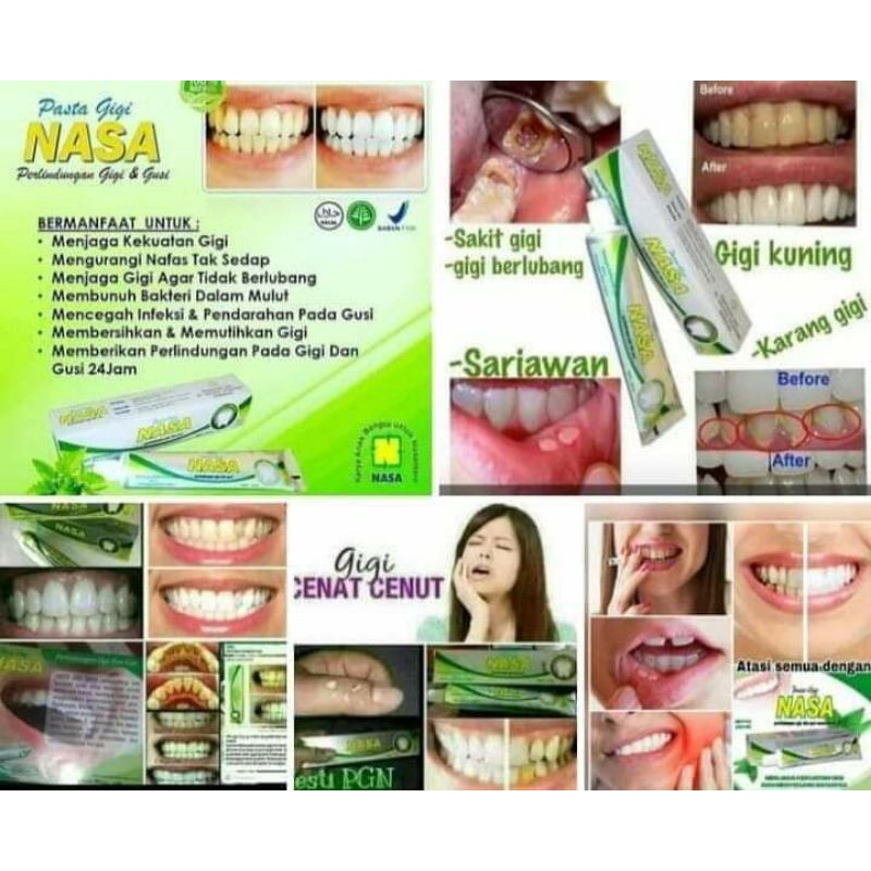 PGN/PASTA GIGI NASA/PASTA GIGI HERBAL/PASTA GIGI HERBAL ORIGINAL NASA