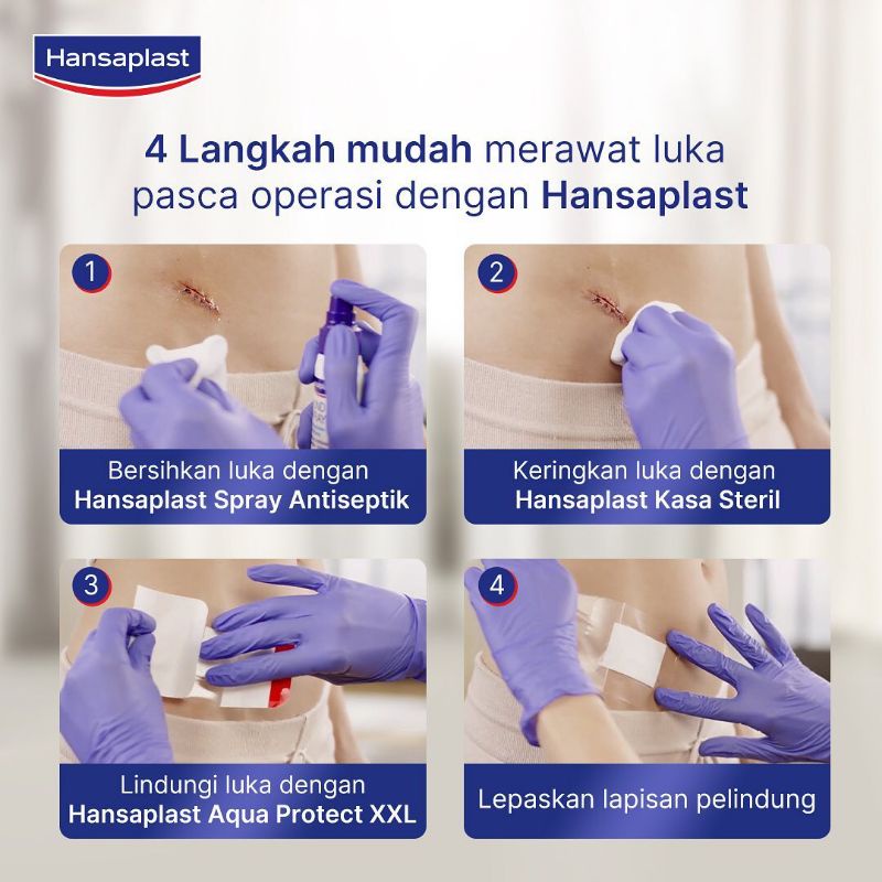 HANSAPLAST KASA STERIL - PENUTUP LUKA