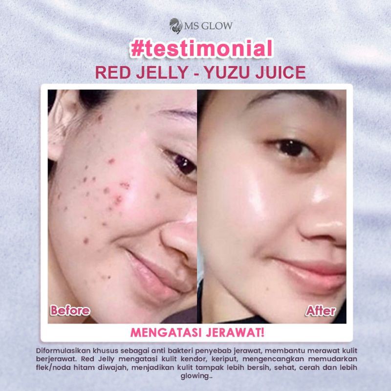 

flawlessglowReDJelly