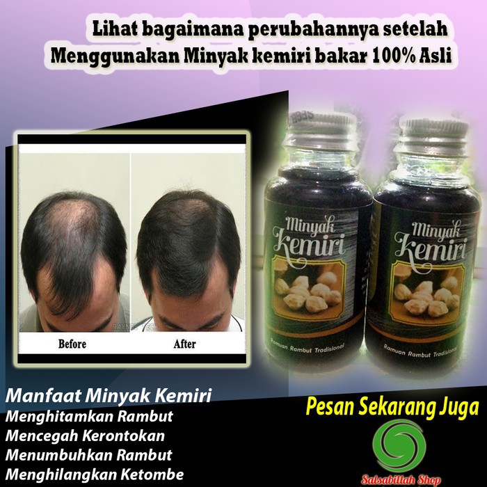 ASLI Obat Penumbuh Penyubur Penghitam Rambut Bayi - Dewasa - Minyak