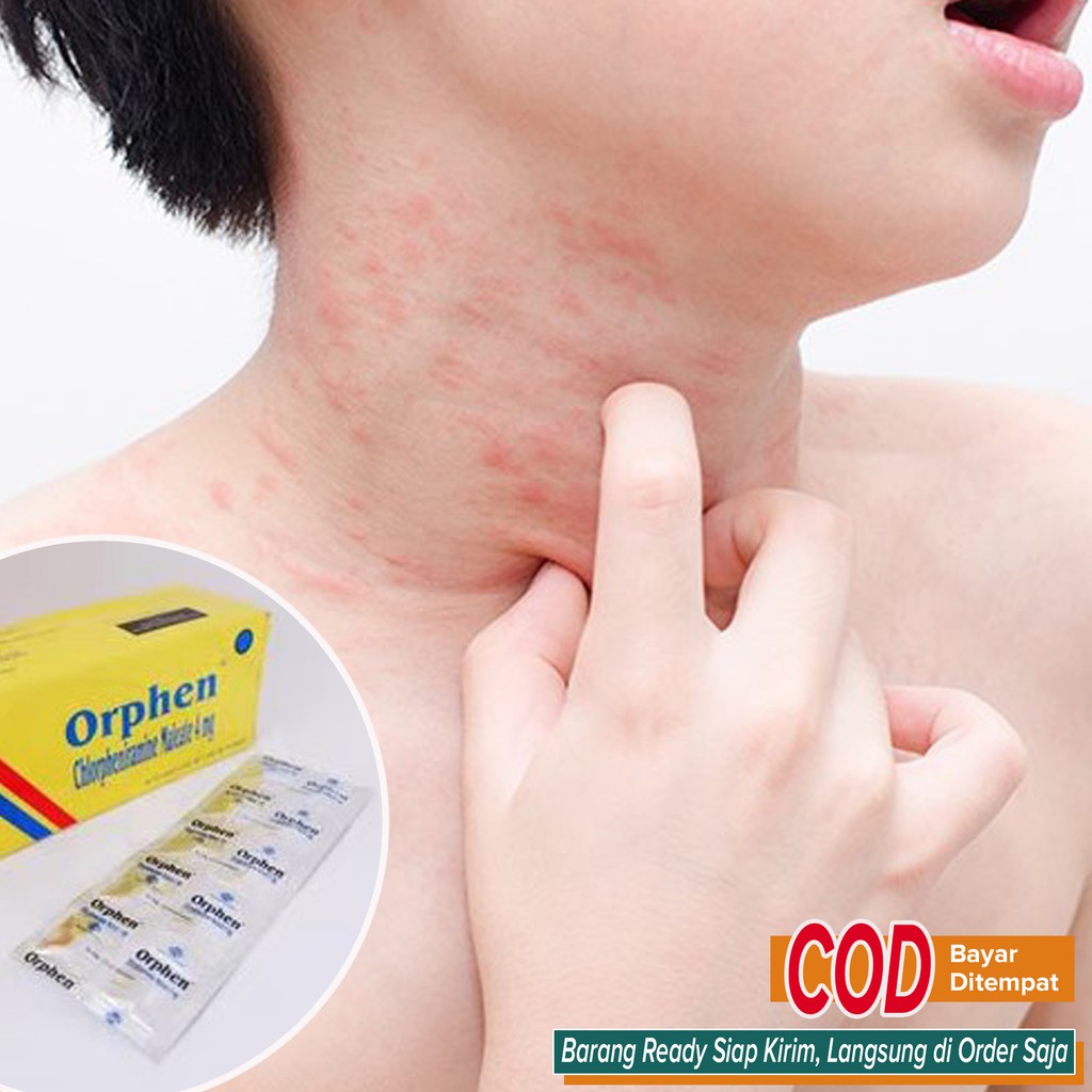 Obat gatal Biang Keringat Gatal Biduran Gatal Alergi Cuaca & Pilek Bersin2 dll AMPUH murah ~ Orphen 