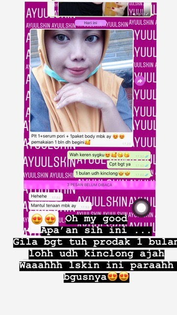 Lskin Platinum 1+  Paket Skin Care Perawatan Wajah Menghilangkan Jerawat Dan Pemutih Wajah-5