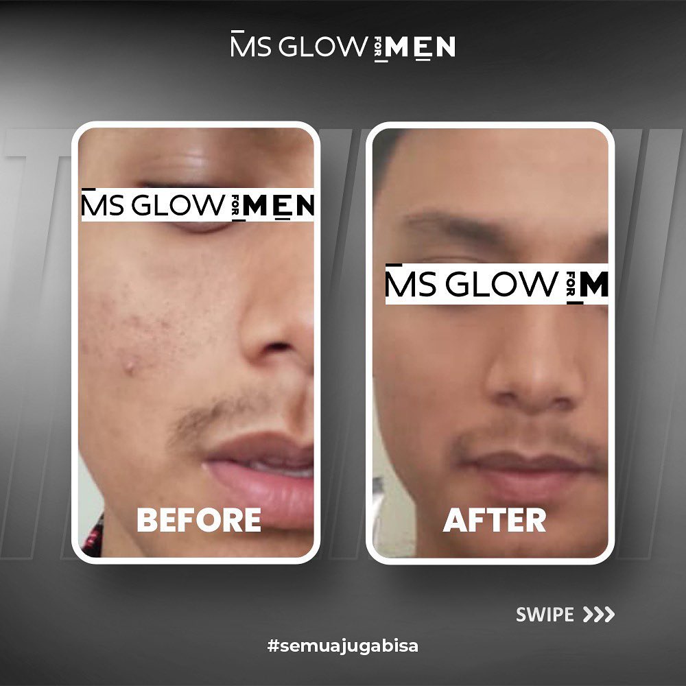 Paket Serum Sabun Cream Ms Glow Men Basic 3 in 1 Original Halal BPOM