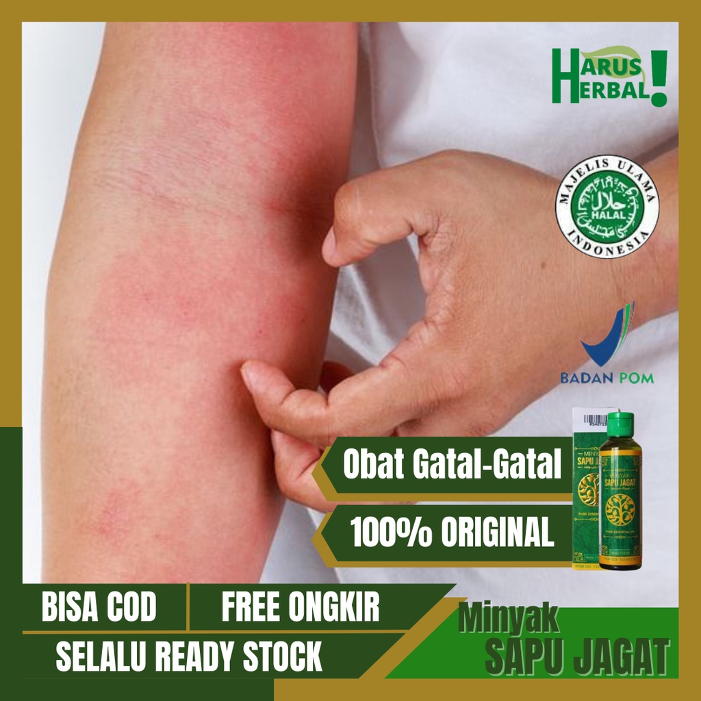 Minyak Balur Gatal-Gatal, Minyak Penghilang Gatal Seluruh Badan, Obat Penghilang Kulit Gatal, Gatal 