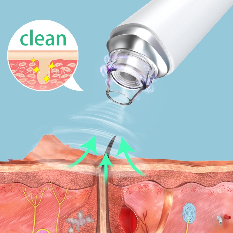 Visual Blackhead Komedo Vacuum Suction Pore Cleaner Camera Electric Face Acne Removal Komedo