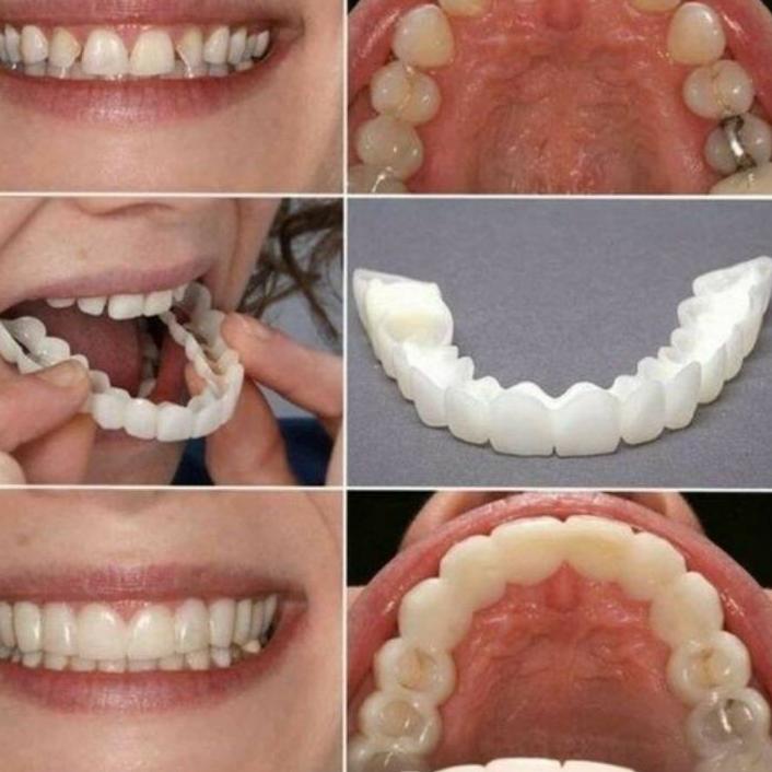 Terbaik Gigi palsu SNAP ON SMILE SEPASANG  GIGI ATAS dan GIGI BAWAH ,,