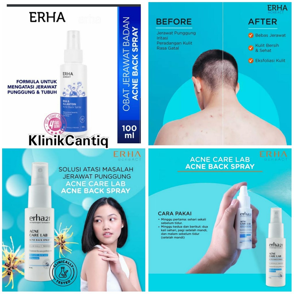 Erha Acne Back Spray Original - Spray Anti Jerawat Badan