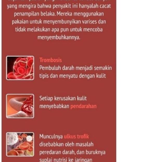 ◊ Varikose Original Cream Varises Terbukti Nyata Hasilnya Bergaransi ❅
