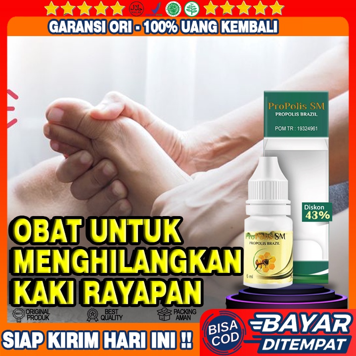 Obat Kaki Rayapan,  Obat Untuk Telapak Kaki Rayapan Obat Telapak Kaki Rayapan, Obat Kaki