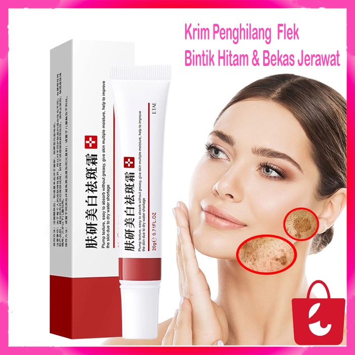 ✅ COD Krim Pemutih Efektif Penghilang Bintik Wajah, Krim Pelembap Melanin Bintik Hitam Pigmentasi 20GKrim Pemutih Efektif Penghilang Bintik Wajah, Krim Pelembap Melanin Bintik Hitam Pigmentasi 20G