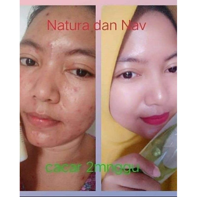 Aloevera Soothing Gel