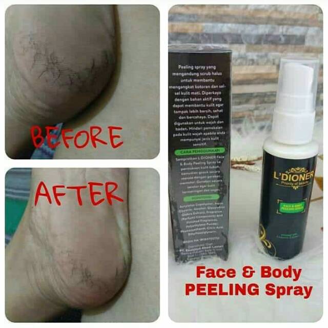 Peeling Spray / Body Face Peeling Spray Ldioner