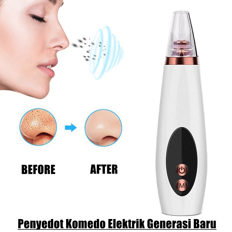 Blackhead Household Electric Blackhead Meter Pore Cleaning Tool Beauty/Blackhead Cleanser Komedo Cleaner Listrik Sedot Kulit Bersih