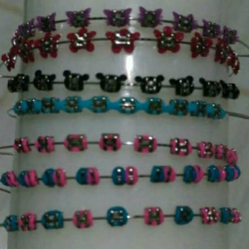 behel lepas pasang
