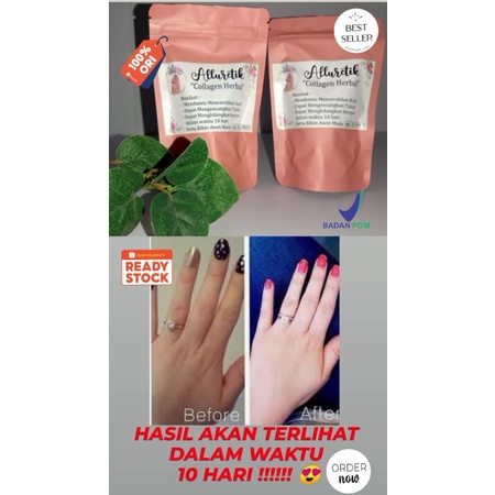 {READY}Collagen aman/pemutih badan permanen /BPOM/collagen whitening 10 kapsul original by alluretik