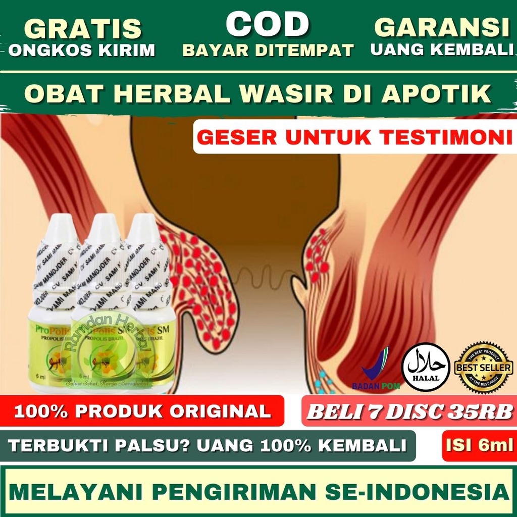 Obat Wasir Di Apotik, Obat Ambeien Di Apotik, Ambeyen, Ambeyen Kronis/Akut, Benjolan Di Anus, Obat H