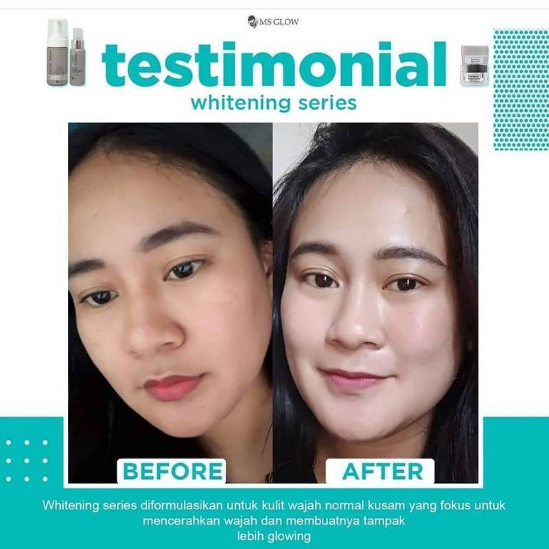 MS GLOW ORIGINAL Whitening Series Termurah BerBPOM Promo Paket Kecantikan MS Glow Termurah