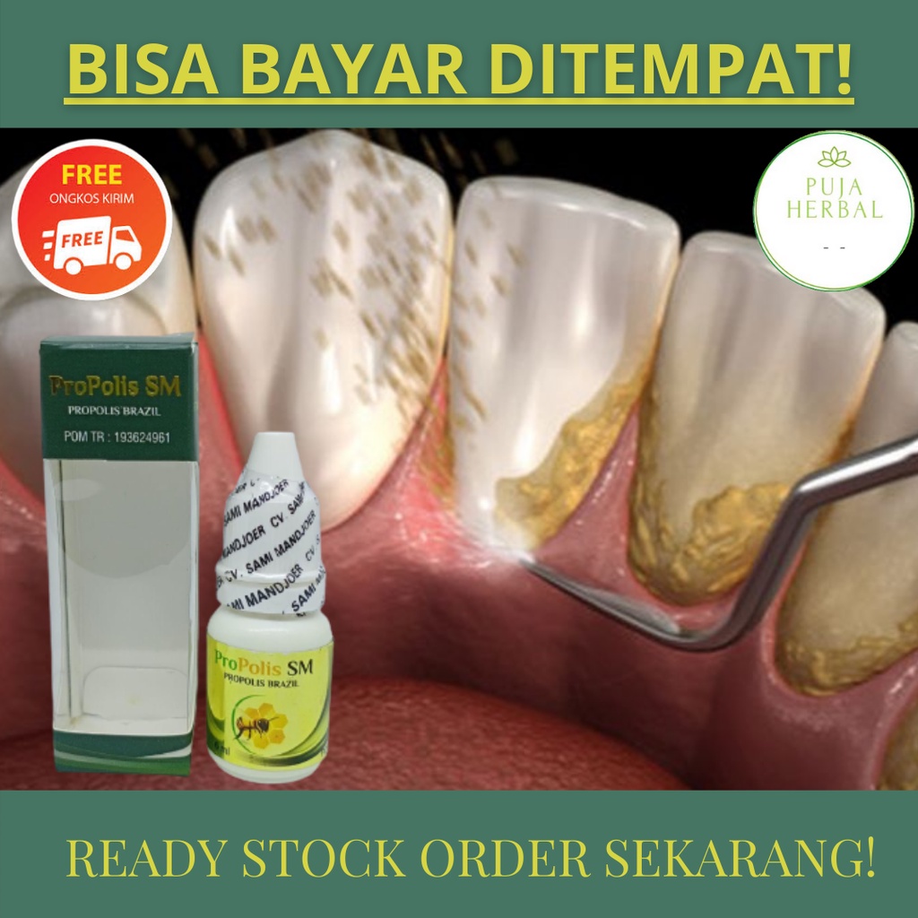 Obat Kumur Pembersih Karang Gigi Penghilang Bau Mulut Pembersih Gigi Kuning - Propolis Brazil SM