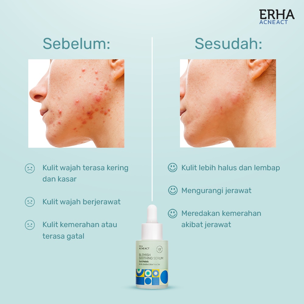 ERHA Serum Wajah AcneAct Blemish Soothing Serum - Kulit Kering &amp; Sensitif