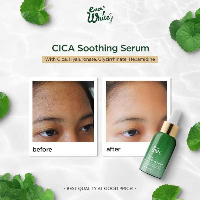 [ORI] EVERWHITE CICA SOOTHING SERUM CENTELLA ASIATICA Terbukti Ampuh Merawat &amp; Melembabkan Kulit Berjerawat - BPOM 30ML