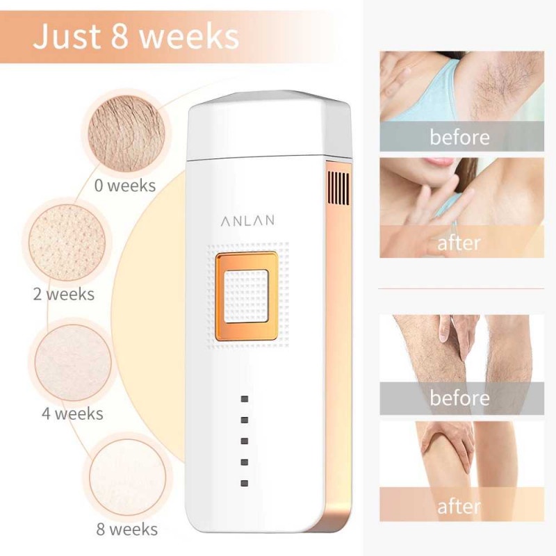 Hair Removal Portable Laser Epilator Penghilang Bulu 500000 Flashes