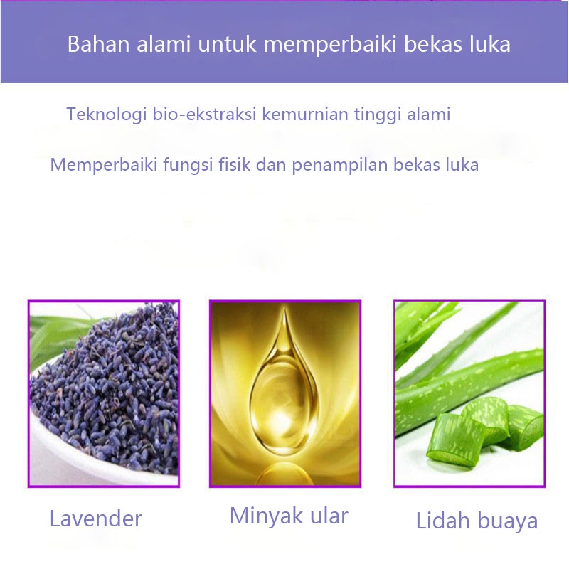 Krim penghilang bekas penghilang bekas luka penghilang bekas jerawat 60g Menghilangkan bekas luka dengan cepat dan lembut stretch mark bekas jerawat mengembalikan kulit halus