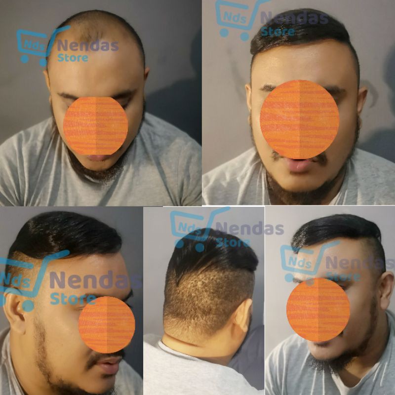 Wig Poni Pria / Hair Toupee / Wig pria / Rambut Palsu Pria