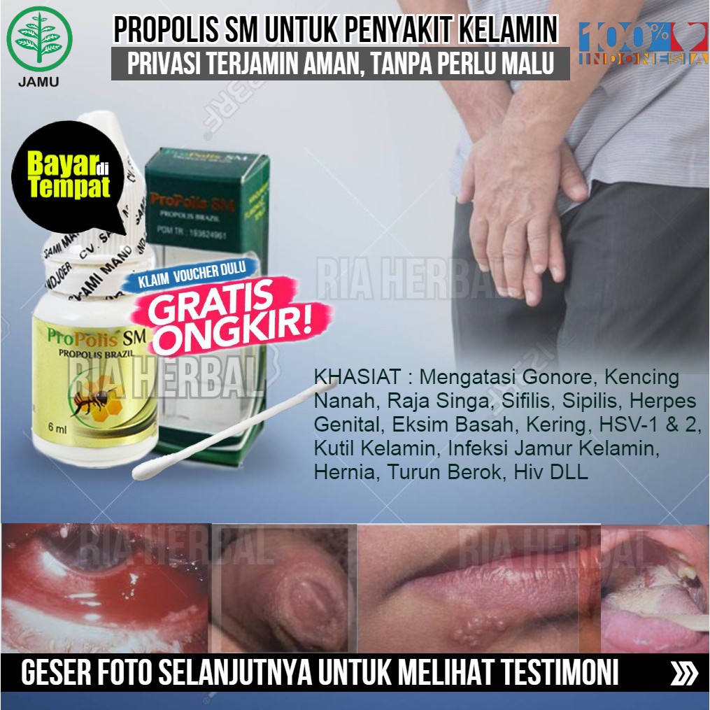 Obat Untuk Gatal Gatal Di Sekitar Kemaluan Tetes Hilangkan Infeksi Jamur Kemaluan Yang Bagus Asli Shopee Indonesia