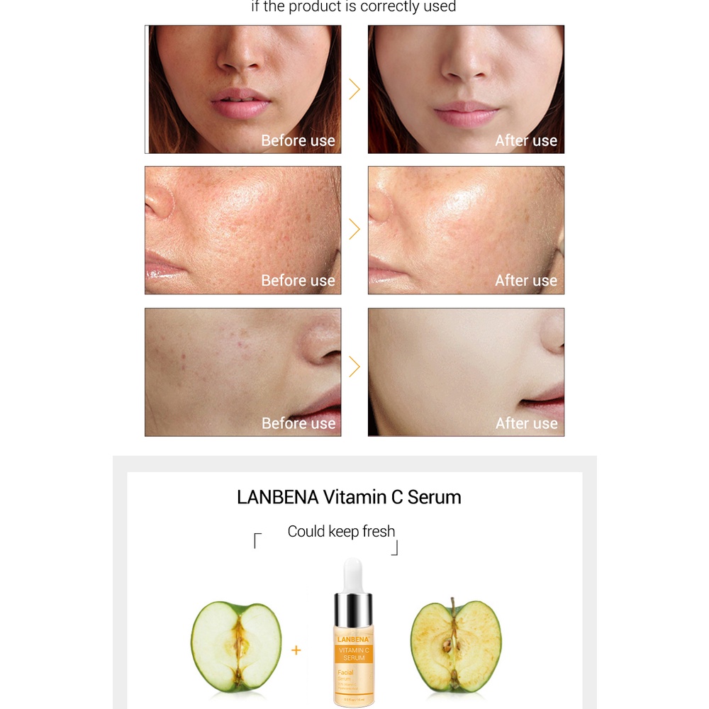 [BARU]LANBENA VITAMIN C SERUM-Mencerahkan Wajah Pemutih Melembabkan Anti-kerut Perawatan kulit (30ml)