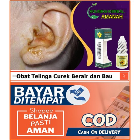 Obat Telinga Curek Berair dan Bau, Congek, Telinga Bernanah, Telinga Berdarah, Infeksi