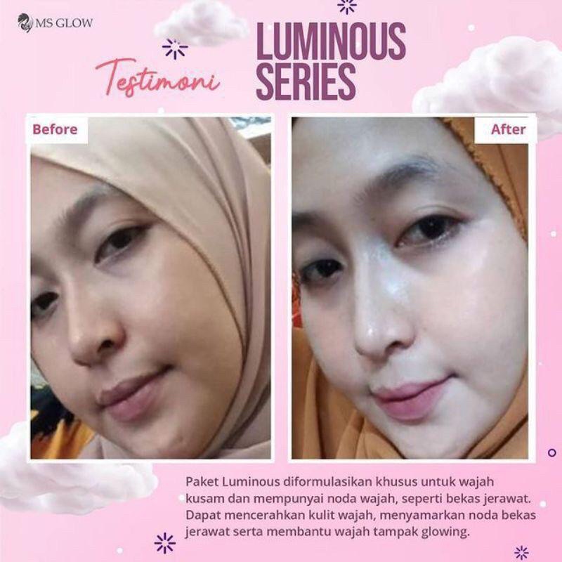 Ms Glow Original Paket Wajah Whitening/Acne/Luminous/Ultimate