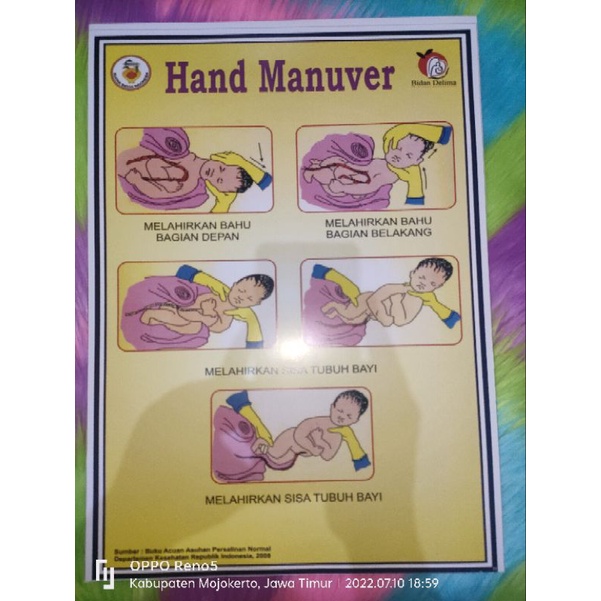

Poster Hand Manuver