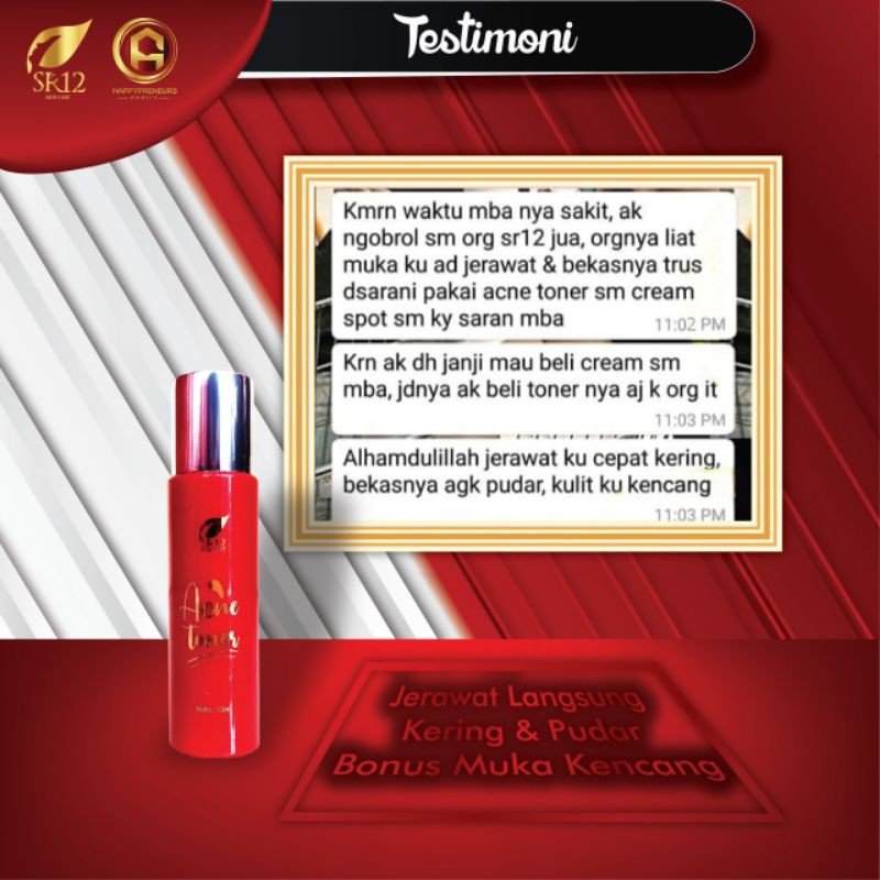 SR12 Acne Toner - Hydrating Toner Untuk Kulit Berminyak dan Berjerawat