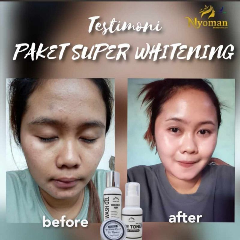 [FREE GIFT] WHITENING PLUS NYOMAN | Paket OILY Nyoman skincare / kemasan baru PAKET SUPER WHITENING NYOMAN SKINCARE | nyoman white plus NEW