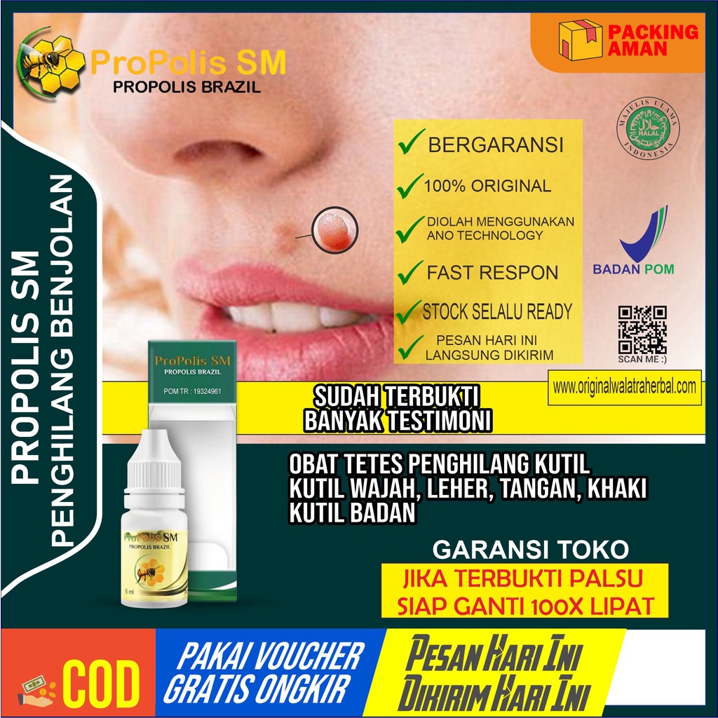 Obat Kutil - Obat Papiloma - Obat Kutil Di Wajah - Penghilang Kutil - Perontok Kutil - Propolis SM