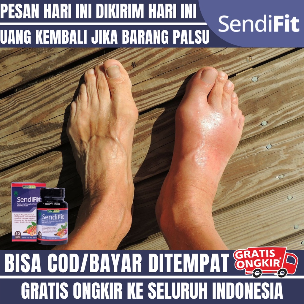 Obat Asam Urat Dan Kolesterol Nyeri Sendi, Obat Asam Urat Dan Flu Tulang, Obat Sakit Tumit Kaki Dan 