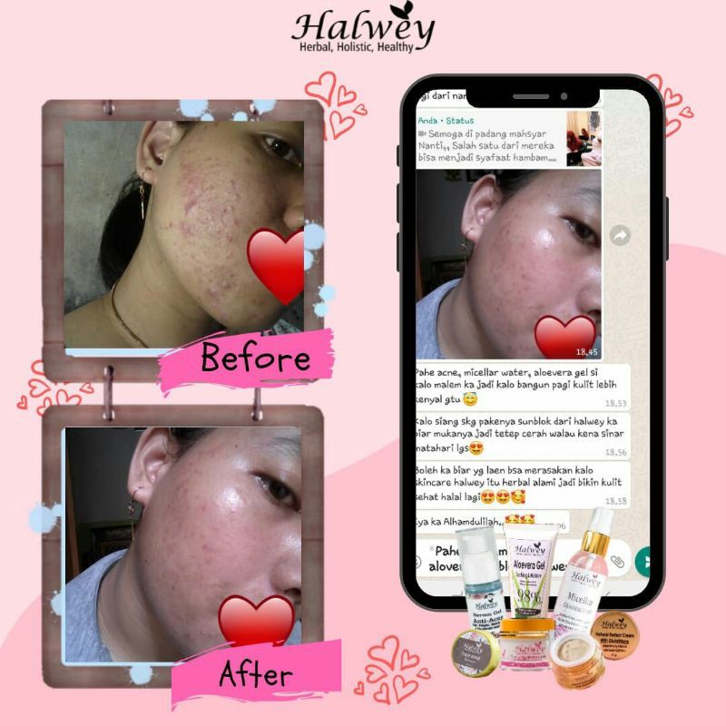 testimoni halwey skincare