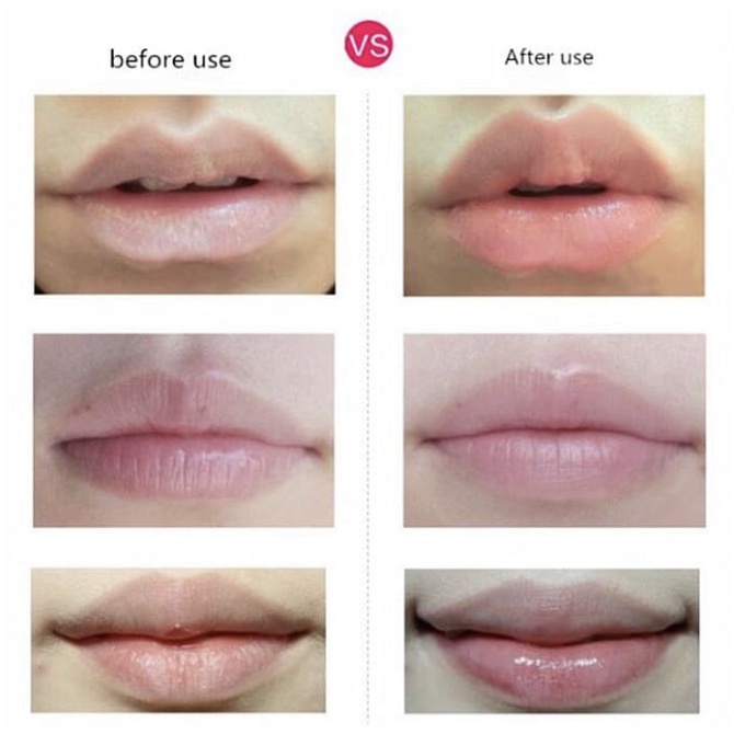 Keynie Lip Mask Collagen Nourish Mask Pelembab Bibir BA001