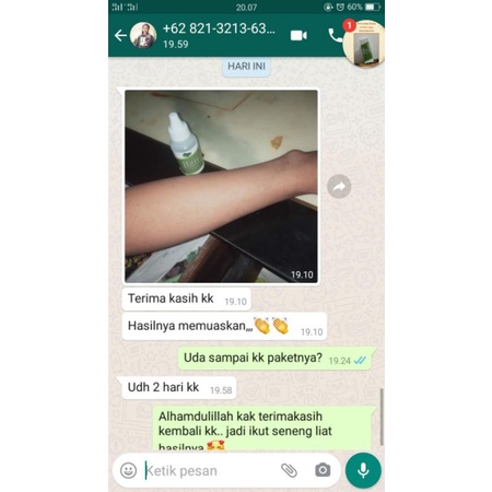 HOVECA Hair Removal SPRAY Permanen dan aman Perontok Penghilang Bulu Ketiak Miss V Kemaluan Missv Kaki Tangan Dada Remover