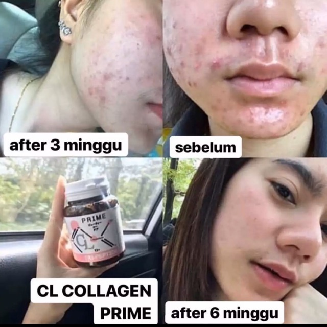 CL Prime Collagen