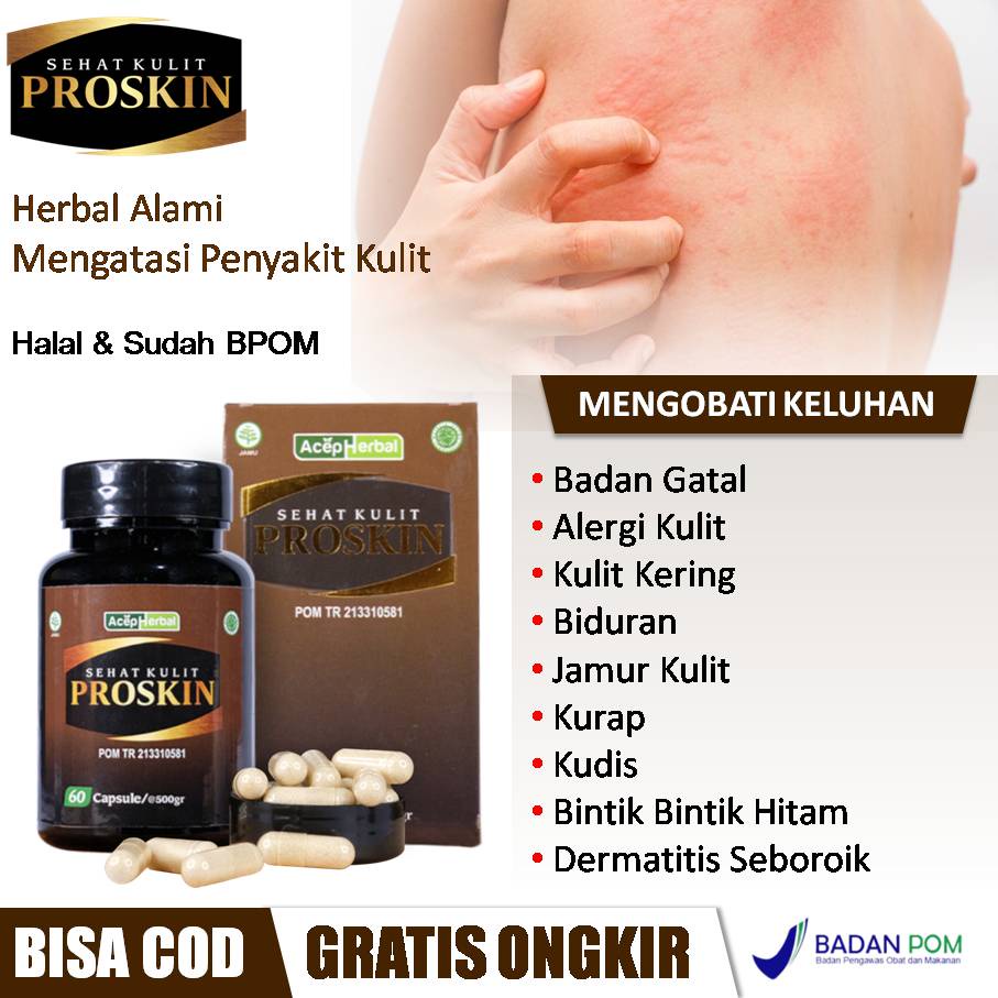 Obat Badan Gatal, Kulit Kering, Infeksi Kulit, Biang Keringat, Alergi, Dermatitis  Kontak, Dermatiti