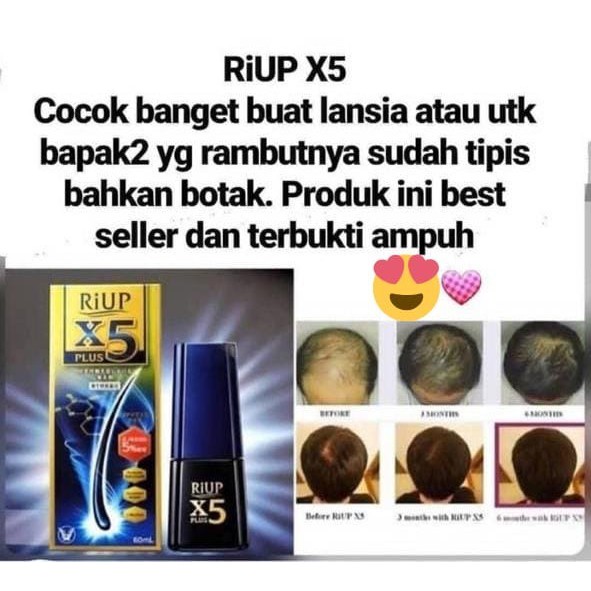 [READY STOCK] RIUP X5 PLUS Neo Japanese Hair Loss Cure for Men 60ml