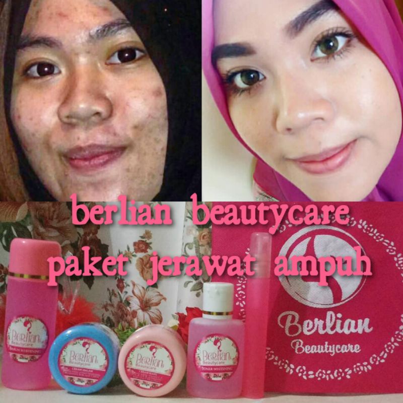 PAKET JERAWAT AMPUH BERLIAN BEAUTYCARE 100% JERAWAT PERGI