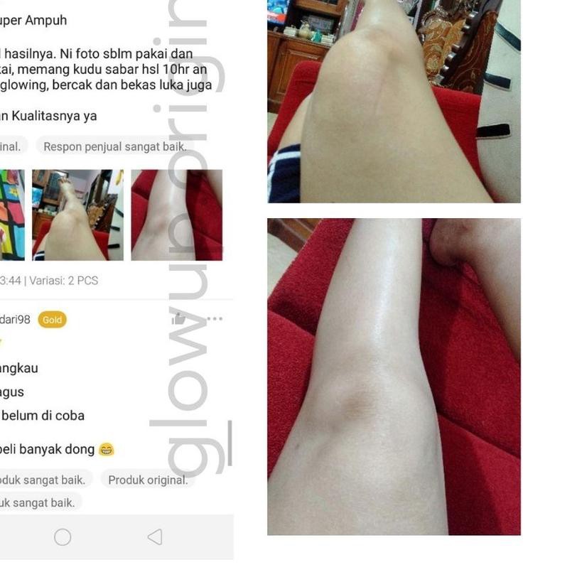 ♥ PEMUTIH SUPER GLOW UP | GLOWUPINDO | GLOWUPID | 3PCS ☋