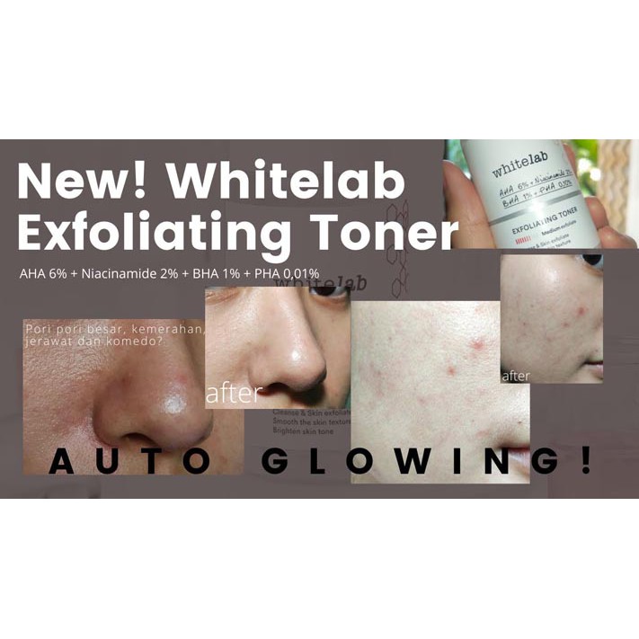 Whitelab Exfoliating Toner