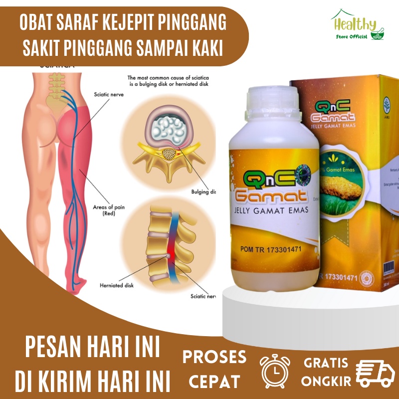 Obat Saraf Kejepit, Obat Sakit Pinggang, Obat Saraf Kejepit pinggang, Obat saraf kejepit herbal, Oba