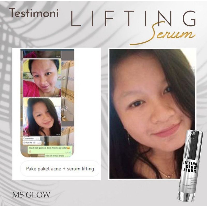 SERUM MS GLOW / SERUM LUMINOUS MS GLOW / SERUM LIFTHING MS GLOW / SERUM ACNE / GOLD SERUM WAJAH