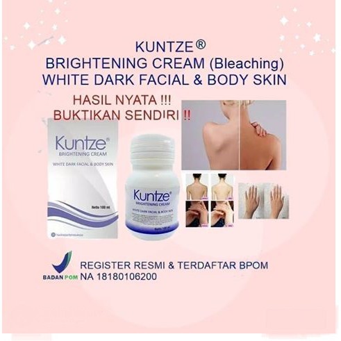 (BOSS) KUNTZE Bleaching Brightening Cream With Dark Facial &amp; Body Skin