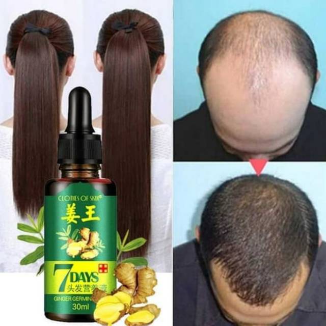 SERUM ANTI BOTAK Ginger King 7 Days Germinal Hair Oil 30ml Minyak Esennsial Ginseng Serum Penumbuh R
